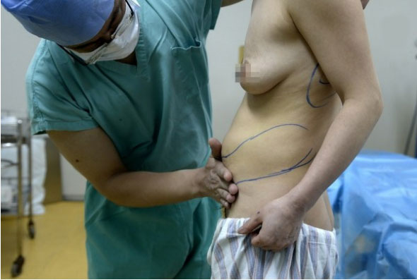 [视频]女子为挽留出轨丈夫隆胸 12年后胸移动到后背
