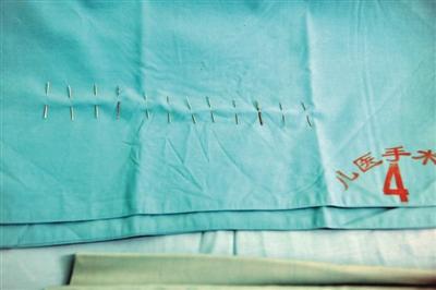[视频]山东聊城一女婴体内被扎12根针追踪：被扎针女婴体内12根针全部取出