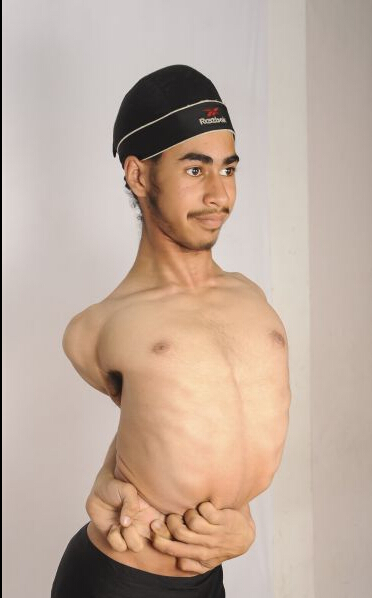 [视频]印度“橡胶男孩” 头转180度不费力（图）