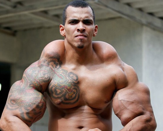 [视频]巴西男子手臂注射燃油变身绿巨人 差点被截肢