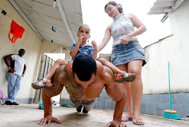 [视频]巴西男子手臂注射燃油变身绿巨人 差点被截肢