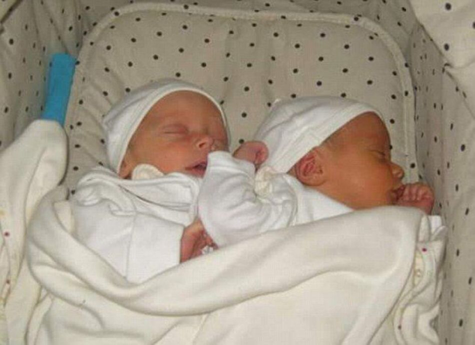 [视频]白人妈妈和混血爸爸生下罕见“黑白配”双胞胎