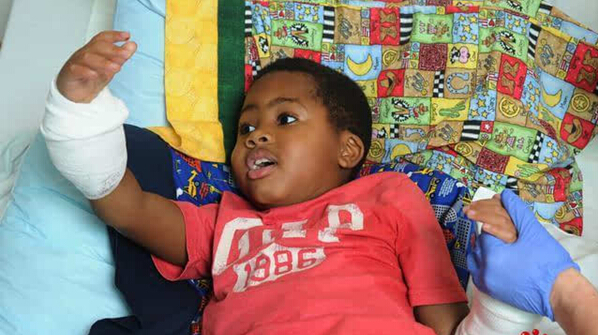 [视频]美国一8岁男孩成功移植双手 来自两名捐赠者