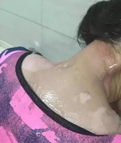 [视频]监控：服务员与女顾客起争执 将热汤浇其头上