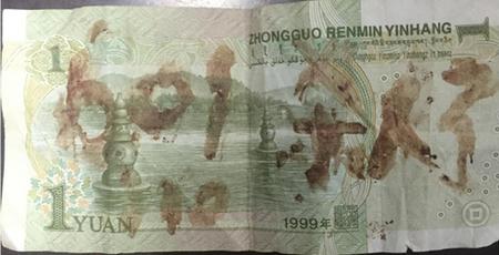 [视频]男子身陷传销窝点 一元纸币上写“血书”求救