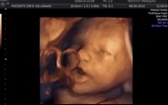 [视频]胎儿在子宫里听到音乐做“鬼脸” 吐长舌头