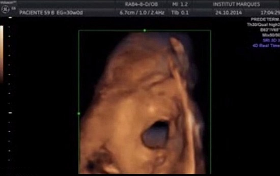 [视频]胎儿在子宫里听到音乐做“鬼脸” 吐长舌头
