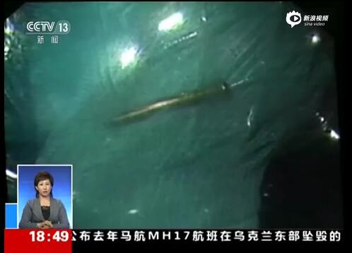 [视频]顽童意外吞钉致刺入肠壁 医生巧妙取出