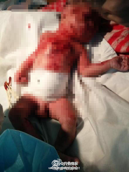 [视频]15岁女孩产子后用竹签将其刺伤 男婴已死亡 