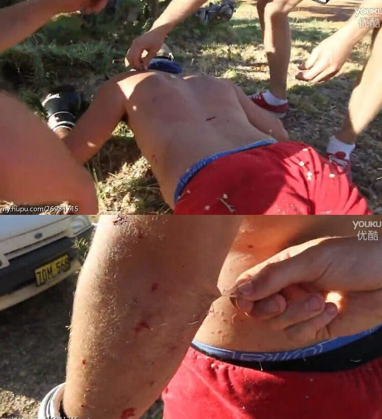 [视频]不作不会死！逗比男子赤膊上身跳进仙人掌里