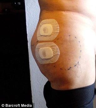 [视频]外籍变性男子整形成瘾 整容156次和妻子似姐妹