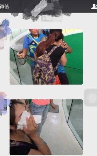 [视频]泰国：女游客亲吻蟒蛇 不料被一口咬中鼻子
