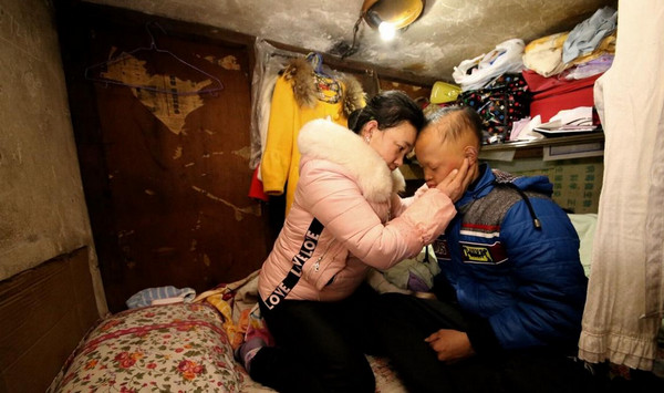 [视频]重庆15岁少年得怪病 长“獠牙”怕见光