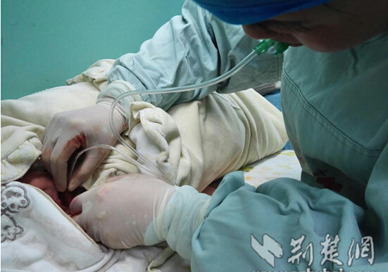 [视频]婴儿被羊水胎粪堵喉 护士嘴吸异物救命