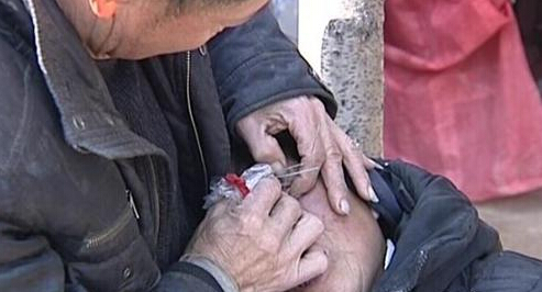 [视频]实拍女子眼睛里出石头 玉米粒大能挖出来