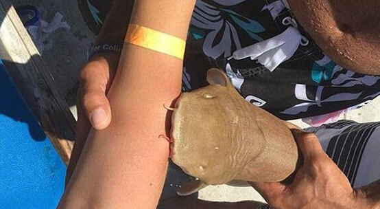 [视频]好一只任性鲨鱼！咬住游客手臂不松口一起被送医