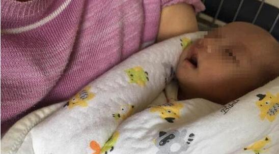 [视频]女子产下罕见胎中胎 哥哥肚里还有一个娃