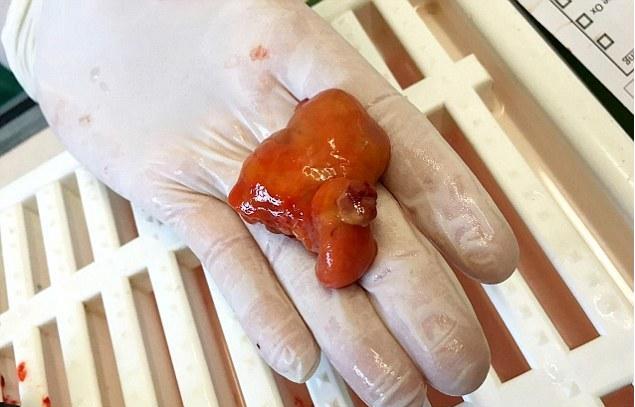 [视频]5岁金鱼接受45分钟手术 成功切除肿瘤