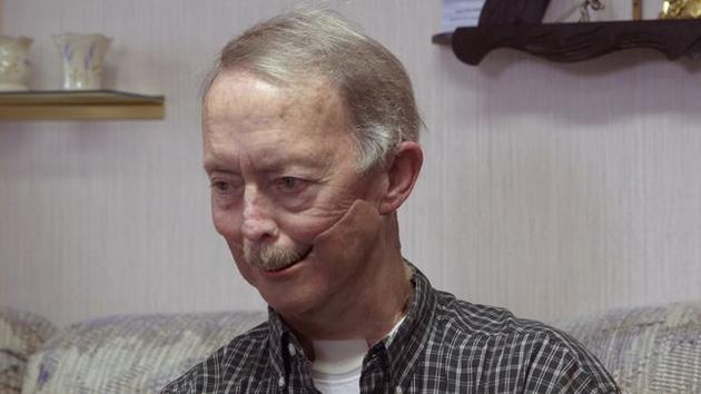 [视频]当医学遇上3D打印 医生给患者换了个下巴