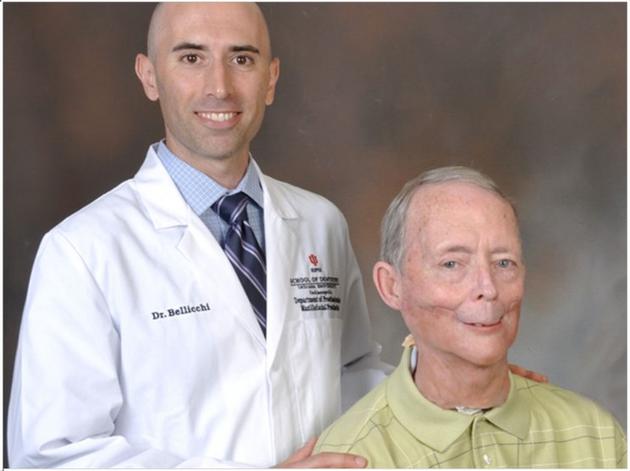 [视频]当医学遇上3D打印 医生给患者换了个下巴