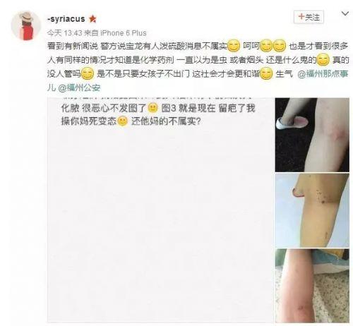 [视频]多名穿短裙姑娘被泼不明液体 灼烧刺痛