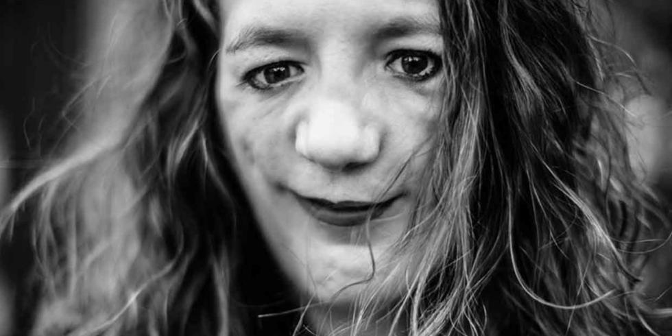 [视频]女子天生脸部缺陷 为当模特经历100次手术