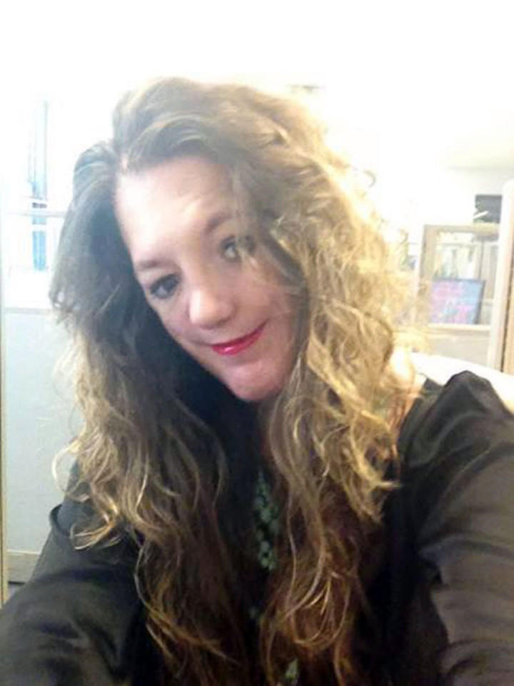 [视频]女子天生脸部缺陷 为当模特经历100次手术