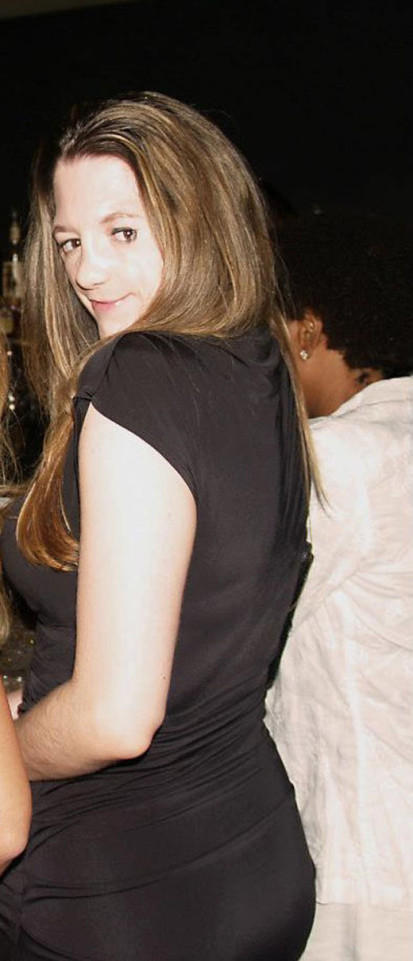 [视频]女子天生脸部缺陷 为当模特经历100次手术