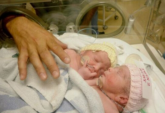 [视频]英连体婴姐妹分离术后存活 如今手拉手上学