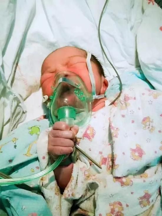 [视频]宝宝手拿氧气罩吸氧 超励志