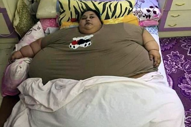世界上最胖的人一亿图片